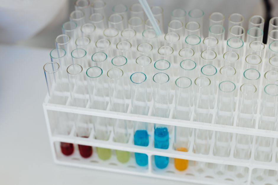 Gradilla de tubos de ensayo en un laboratorio, con algunos tubos llenos de soluciones de colores
